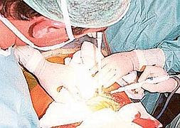 En busca del hígado perfecto